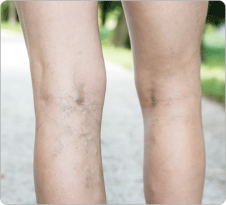 �������Ʒ� �׸�