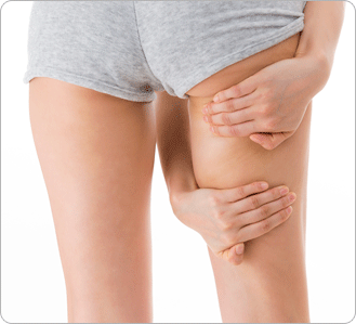 �������Ʒ� �׸�