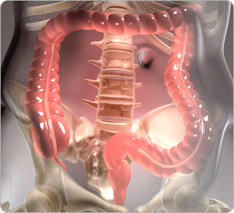 ����� �׸�