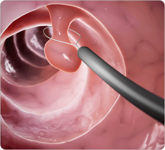 ������� �׸�