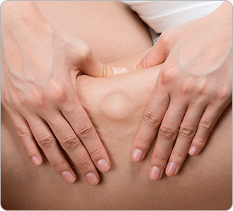 ������ �׸�